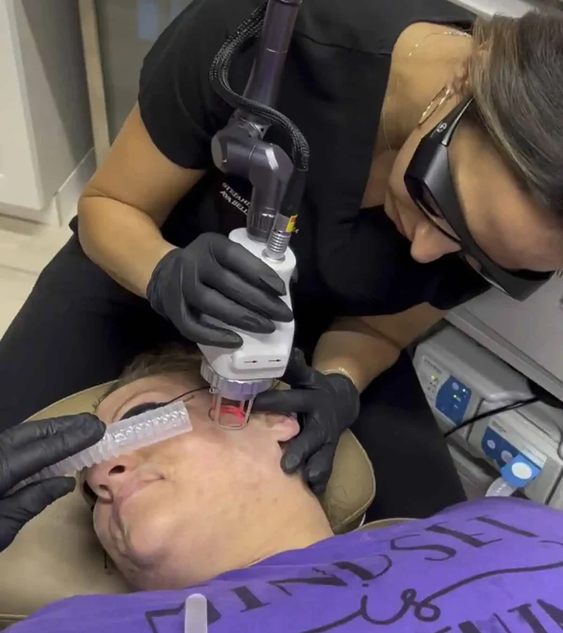 Phoenix CO2 Laser new